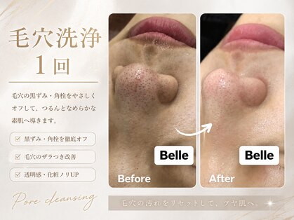 ベル 心斎橋店(Belle)の写真