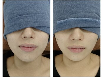 ウルオス/大好評!痛気持ち良い小顔矯正♪