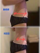 クレアボディ(CREA BODY)/お腹