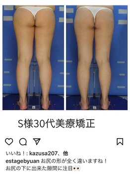 エステージ(estage)/