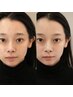 ［学割U24］眉毛ワックス(間引き・メイクレクチャー込み)