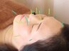 【たるみシワ/ほうれい線】ポイント重視の美容鍼 ★口コミ500円引き