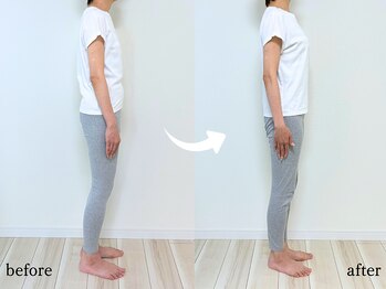 エーアール(AR)/【Before/After】