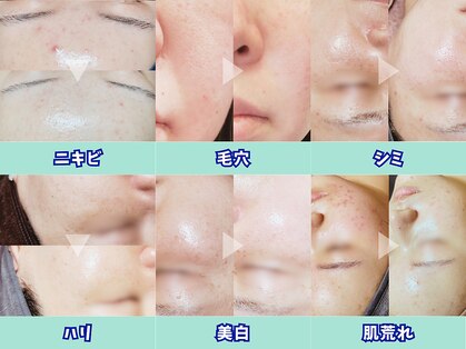 ゼニス 池袋本店(ZENITH)の写真