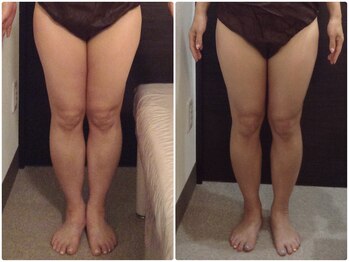 美容整体ウェリナ 名駅院/小顔矯正/骨盤矯正/美脚サロン