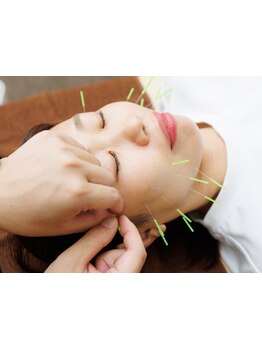 鍼灸施術を受けたい