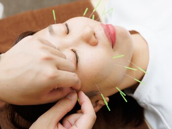 大宮ウィル鍼灸整骨院の写真/美容鍼灸で理想のお肌を手に入れませんか?お顔のお悩みを根本から改善します!
