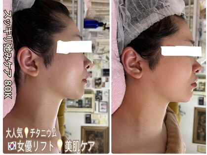 アルページュ(Arpege)の写真
