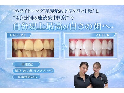 ホワイトニングショップ 三田店の写真