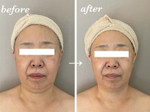 スゥ(Sod)/小顔矯正コルギ/整体・リンパ