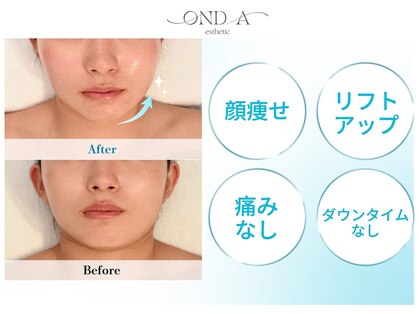 ONDエステティック(OND Aesthetic)の写真