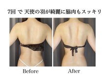 ナチュラーレ 天王寺店(Naturale)/痩身リンパマッサージ二の腕美脚