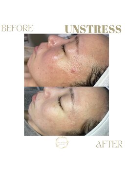 ネス 沖縄店(Nes.)/UNSTRESS/アンスレス