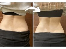 加圧スタジオ プラテア 西船橋店(PLATEA)/痩身ダイエットもお任せ◎