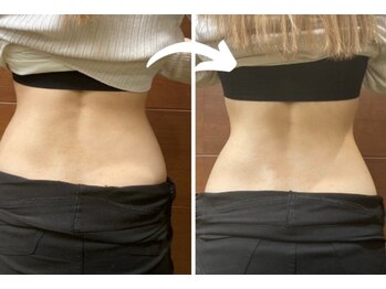 加圧スタジオ プラテア 西船橋店(PLATEA)/痩身ダイエットもお任せ◎