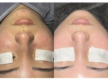 スナチュラル(Snatural)/あらゆるお肌悩みにアプローチ♪