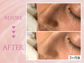 クリアラボ 川崎(Clear Lab)/韓国式肌管理&毛穴洗浄専門店