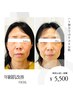 【美肌/むくみケア】潤いスキンケアコース+ラジオ波65分¥7,700→¥5500