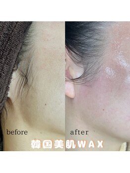 プルティティア(Pultitia)/