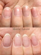 マリーロール 梅田店(Marie Laure)/深爪改善/自爪育成/ネイルケア