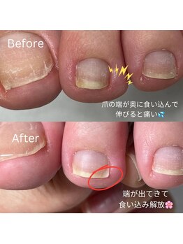 小さい違和感もケア