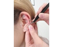 ソイズエステティクス