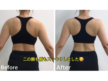 セラビシャン/before→after【背中、二の腕】