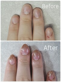 深爪矯正グラデーションスカルプ