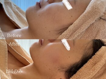 サロン ド ビビ(salon de bibi*)/横顔の印象が変わる！