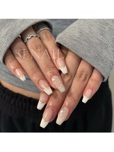 エスアイネイル(SI Nail)/