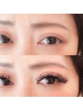 ジュピ(Jupi)/Before→After