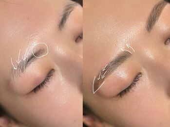 リンクビーワクシング(LINK B WAXING)/