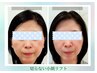 【お誕生日の方限定】小顔フルコース90～120分￥38,500⇒　