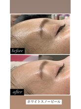 サロン ド マーシャ(salon de Marsha)/ホワイトスノーピール