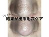 【当日実感】毛穴全顔取り放題！話題の毛穴エクストラクション ¥14,000→