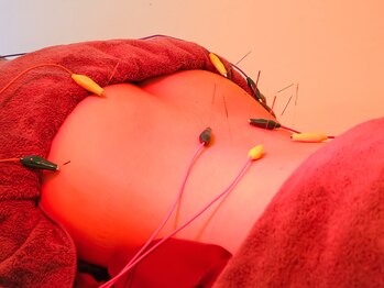 ユジュアンド(YUJ&)/腰の鍼