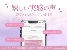 キャロリーヌ新宿店の雰囲気（フォトギャラリーにお客様のお声を一部掲載中♪[シミシワケア]）