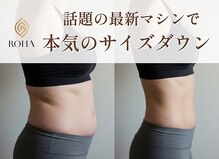 ローハ(ROHA)