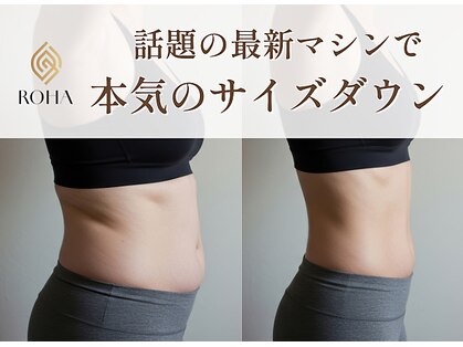 ローハ(ROHA)の写真