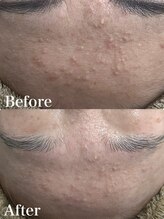 ビビィ(Bibiy)/クリスティーナ/ビオフィート