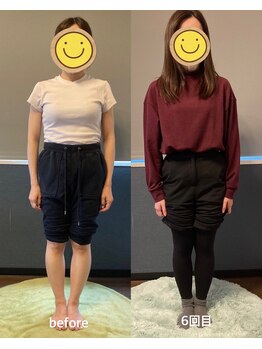 灯(akari)/O脚から美脚へ!20代女性