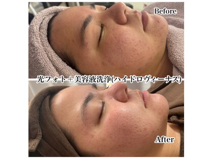 ルアナ(LUANA)の写真