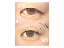 プナヘレ(Punahele)/アンドヘルシー１２０本まで