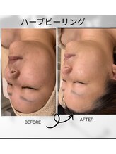 トゥーセブンネイルズ(TwoSevenNails)/before &nbsp;or &nbsp;after