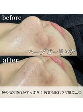 エムラボ 麻布十番店(M LABO)/ビフォーアフター
