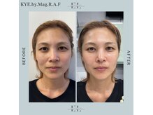 キー バイ マグラフ 南松本店店(KYE by Mag R.A.F)の雰囲気（【エクソリフト】本気の肌質改善/たるみくすみ改善/毛穴/肌荒れ）