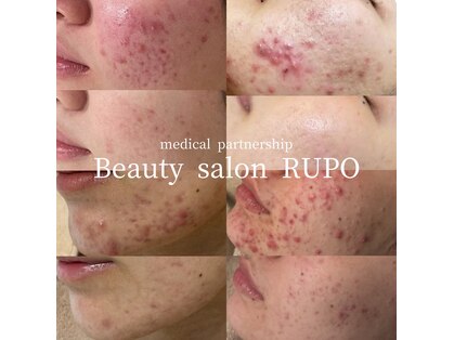 ルポ(RUPO)の写真