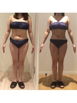 アユアラングレース/腹囲-15cm!若見せボディへ!