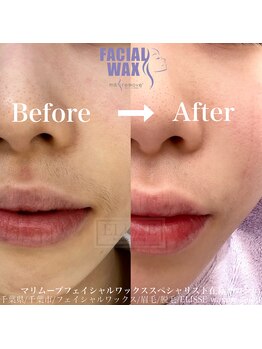 エリス(ELISSE)/マリムーブフェイシャルワックス