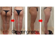 エヴァーグレース 金山店/脚引き締めで美脚を目指せる♪